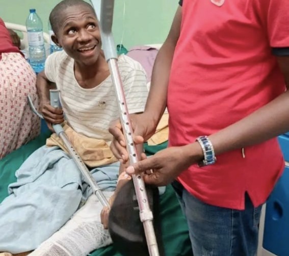 ADALBERTO COSTA,GASTA MILHÕES PARA HITLER SAMUSSUKU E DITO DALI E NÃO PARA SI QUE PARTIU A PERNA NOS PROTESTOS AFAVOR DA UNITA