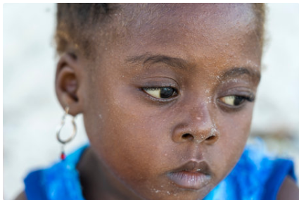 A Face Humana da Crise: A Luta do Povo Angolano Contra a Fome